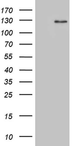 DACT1 Monoclonal Antibody (OTI13H4), TrueMAB , OriGene:Antibodies:Primary