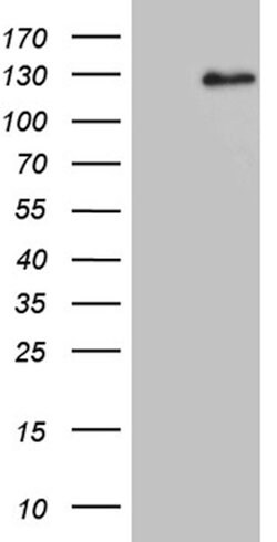DACT1 Mouse anti-Human, Clone: OTI10F12, lyophilized, TrueMAB 100 &mu;g;
