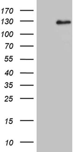 DACT1 Monoclonal Antibody (OTI10F12), TrueMAB , OriGene:Antibodies:Primary