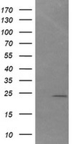 DAND5 Monoclonal Antibody (OTI3D4), TrueMAB , OriGene:Antibodies:Primary