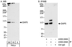 DAP5 Rabbit anti-Human, Polyclonal, Bethyl Laboratories 100 &mu;L; Unconjugated:Antibodies,