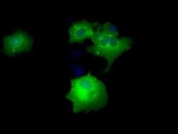 DAPK2 Monoclonal Antibody (OTI1F7), TrueMAB , OriGene 100 &mu;L; Unconjugated:Antibodies,