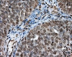 DAPK2 Monoclonal Antibody (OTI1F7), TrueMAB , OriGene 100 &mu;L; Unconjugated:Antibodies,