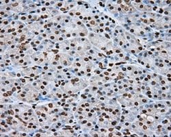 DAPK2 Monoclonal Antibody (OTI1F7), TrueMAB , OriGene 100 &mu;L; Unconjugated:Antibodies,