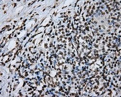DAPK2 Monoclonal Antibody (OTI1F7), TrueMAB , OriGene 100 &mu;L; Unconjugated:Antibodies,