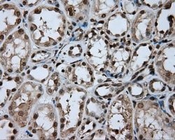 DAPK2 Monoclonal Antibody (OTI1F7), TrueMAB , OriGene 100 &mu;L; Unconjugated:Antibodies,