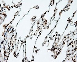 DAPK2 Monoclonal Antibody (OTI1F7), TrueMAB , OriGene 100 &mu;L; Unconjugated:Antibodies,