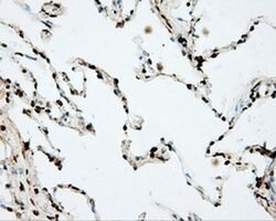 DAPK2 Monoclonal Antibody (OTI1C8), TrueMAB , OriGene 100 &mu;L | Buy Online | Origene Technologies | Fisher Scientific