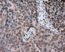 DAPK2 Monoclonal Antibody (OTI1B5), TrueMAB , OriGene 30 &mu;L; Unconjugated:Antibodies,