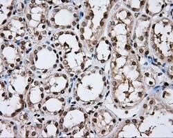 DAPK2 Mouse anti-Human, Clone: OTI1B5, lyophilized, TrueMAB 100 &mu;g;