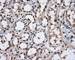 DAPK2 Monoclonal Antibody (OTI1B5), TrueMAB , OriGene 30 &mu;L; Unconjugated:Antibodies,
