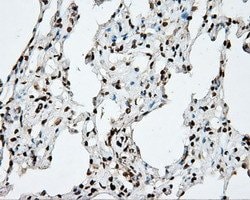 DAPK2 Mouse anti-Human, Clone: OTI1B5, lyophilized, TrueMAB 100 &mu;g;