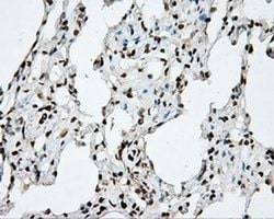 DAPK2 Monoclonal Antibody (OTI1B5), TrueMAB , OriGene:Antibodies:Primary