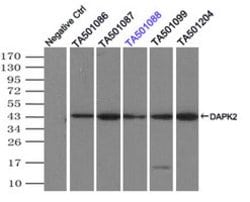 DAPK2 Mouse anti-Human, Clone: OTI1B5, lyophilized, TrueMAB 100 &mu;g;