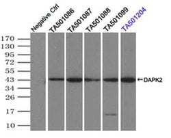 DAPK2 Monoclonal Antibody (OTI1B10), TrueMAB , OriGene 30 &mu;L; Unconjugated:Antibodies,
