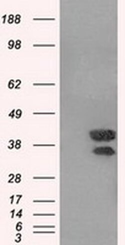 DAPK2 Monoclonal Antibody (OTI1C8), TrueMAB , OriGene 100 &mu;L | Buy Online | Origene Technologies | Fisher Scientific