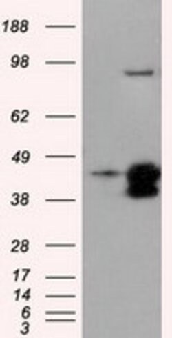 DAPK2 Mouse anti-Human, Clone: OTI1B5, lyophilized, TrueMAB 100 &mu;g;