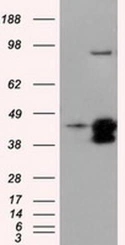 DAPK2 Monoclonal Antibody (OTI1B5), TrueMAB , OriGene:Antibodies:Primary