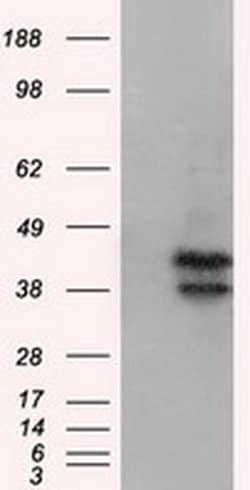 DAPK2 Monoclonal Antibody (OTI1B10), TrueMAB , OriGene 30 &mu;L; Unconjugated:Antibodies,
