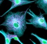 Thumbnail_Donkey anti-Rabbit IgG (H+L) Highly Cross-Adsorbed Secondary Antibody,