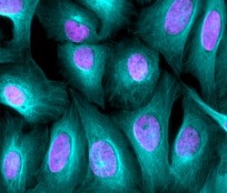 Invitrogen Donkey anti-Rabbit IgG (H+L) Highly Cross-Adsorbed Secondary