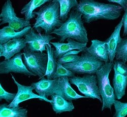 Invitrogen Donkey anti-Rabbit IgG (H+L) Highly Cross-Adsorbed Secondary
