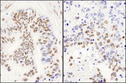 DBC1/p30 DBC Rabbit anti-Human, Mouse, Polyclonal, Bethyl Laboratories