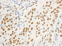 DBC1/p30 DBC Rabbit anti-Human, Mouse, Polyclonal, Bethyl Laboratories