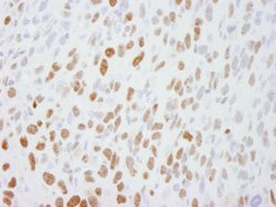 DBC1/p30 DBC Polyclonal Antibody, Bethyl Laboratories 100 &mu;l; Unlabeled:Antibodies,