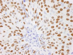 DBC1/p30 DBC Polyclonal Antibody, Bethyl Laboratories 100 &mu;l; Unlabeled:Antibodies,