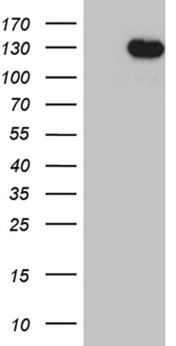 DBN1 Monoclonal Antibody (OTI1B8), TrueMAB , OriGene:Antibodies:Primary