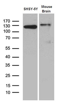 DBN1 Monoclonal Antibody (OTI4G4), TrueMAB , OriGene:Antibodies:Primary