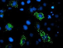 DBT Monoclonal Antibody (OTI1G2), TrueMAB , OriGene:Antibodies:Primary