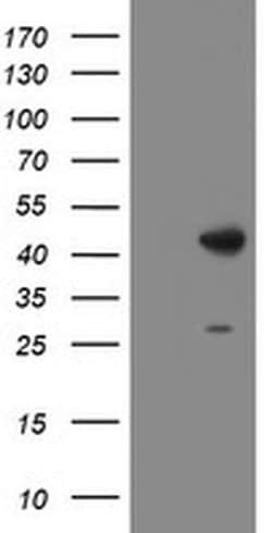DBT Monoclonal Antibody (OTI1G2), TrueMAB , OriGene:Antibodies:Primary