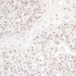 DC8 Rabbit anti-Human, Polyclonal, Bethyl Laboratories 100 &mu;l; Unlabeled:Antibodies,