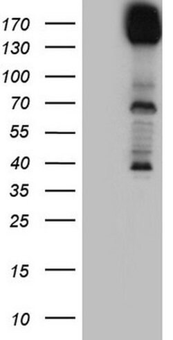 DCC Mouse anti-Human, Clone: OTI5D10, liquid, TrueMAB 100 &mu;L; Unconjugated:Antibodies,