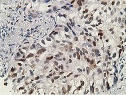 DCK Mouse anti-Human, Clone: OTI16G6, lyophilized, TrueMAB 100 &mu;g; Unconjugated:Antibodies,