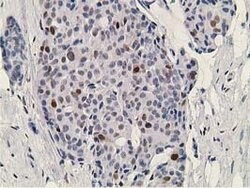 DCK Mouse anti-Human, Clone: OTI16G6, lyophilized, TrueMAB 100 &mu;g; Unconjugated:Antibodies,