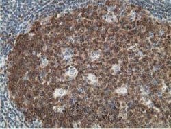 DCK Mouse anti-Human, Clone: OTI16G6, lyophilized, TrueMAB 100 &mu;g; Unconjugated:Antibodies,