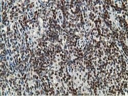 DCK Mouse anti-Human, Clone: OTI16G6, lyophilized, TrueMAB 100 &mu;g; Unconjugated:Antibodies,