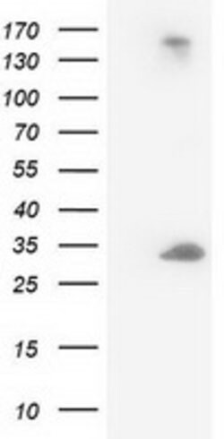 DCK Mouse anti-Human, Clone: OTI16G6, lyophilized, TrueMAB 100 &mu;g; Unconjugated:Antibodies,