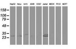 DCK Mouse anti-Human, Clone: OTI16G6, lyophilized, TrueMAB 100 &mu;g; Unconjugated:Antibodies,