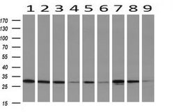 DCK Mouse anti-Human, Clone: OTI16G6, lyophilized, TrueMAB 100 &mu;g; Unconjugated:Antibodies,