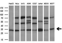 DCK Monoclonal Antibody (OTI15E12), TrueMAB , OriGene:Antibodies:Primary