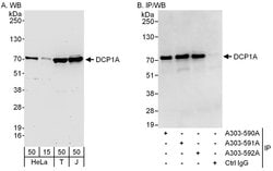 DCP1A Rabbit anti-Human, Polyclonal, Bethyl Laboratories 100 &mu;L; Unconjugated:Antibodies,