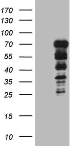 DCP1B Monoclonal Antibody (OTI1G4), TrueMAB , OriGene:Antibodies:Primary