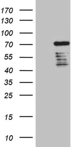 DCP1B Monoclonal Antibody (OTI1G8), TrueMAB , OriGene 100 &mu;L; Unconjugated:Antibodies,