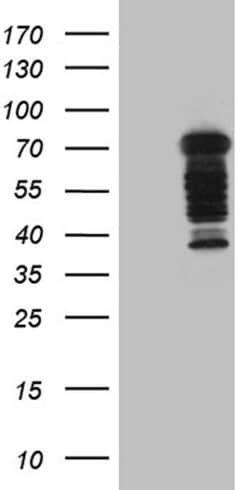 DCP1B Monoclonal Antibody (OTI2D8), TrueMAB , OriGene 100 &mu;L | Buy Online | OriGene | Fisher Scientific