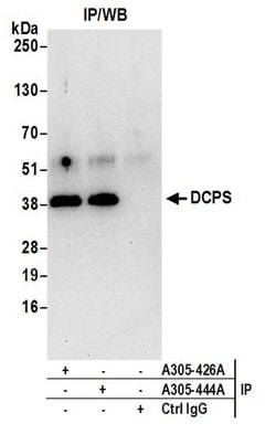 DCPS Rabbit anti-Human, Polyclonal, Bethyl Laboratories 100 &mu;L; Unconjugated:Antibodies,