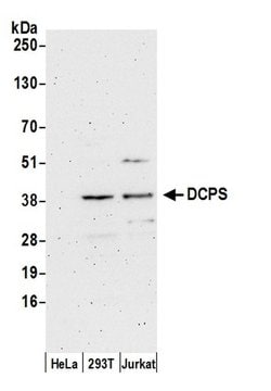 DCPS Rabbit anti-Human, Polyclonal, Bethyl Laboratories 100 &mu;L; Unconjugated:Antibodies,